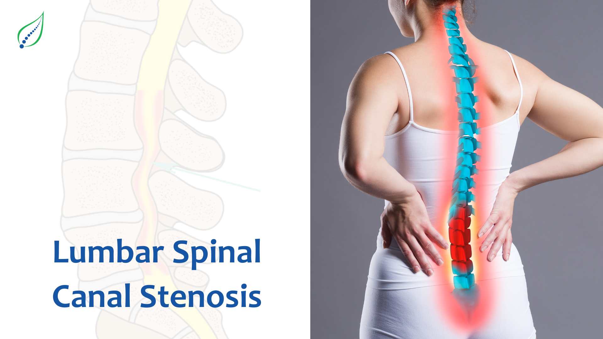 Lumbar Spinal Canal Stenosis: Causes, Symptoms, and Treatments